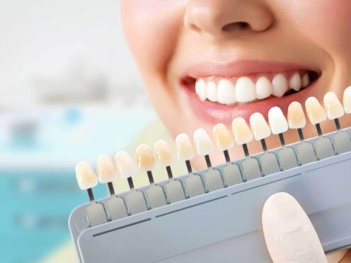 Cosmetic Dentistry