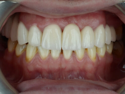 How Can We Transform Your Smile?